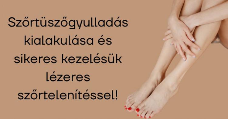 Szőrtüszőgyulladás kialakulása és sikeres kezelésük lézeres szőrtelenítéssel! Szőrtüszőgyulladás kialakulása és sikeres kezelésük lézeres szőrtelenítéssel!